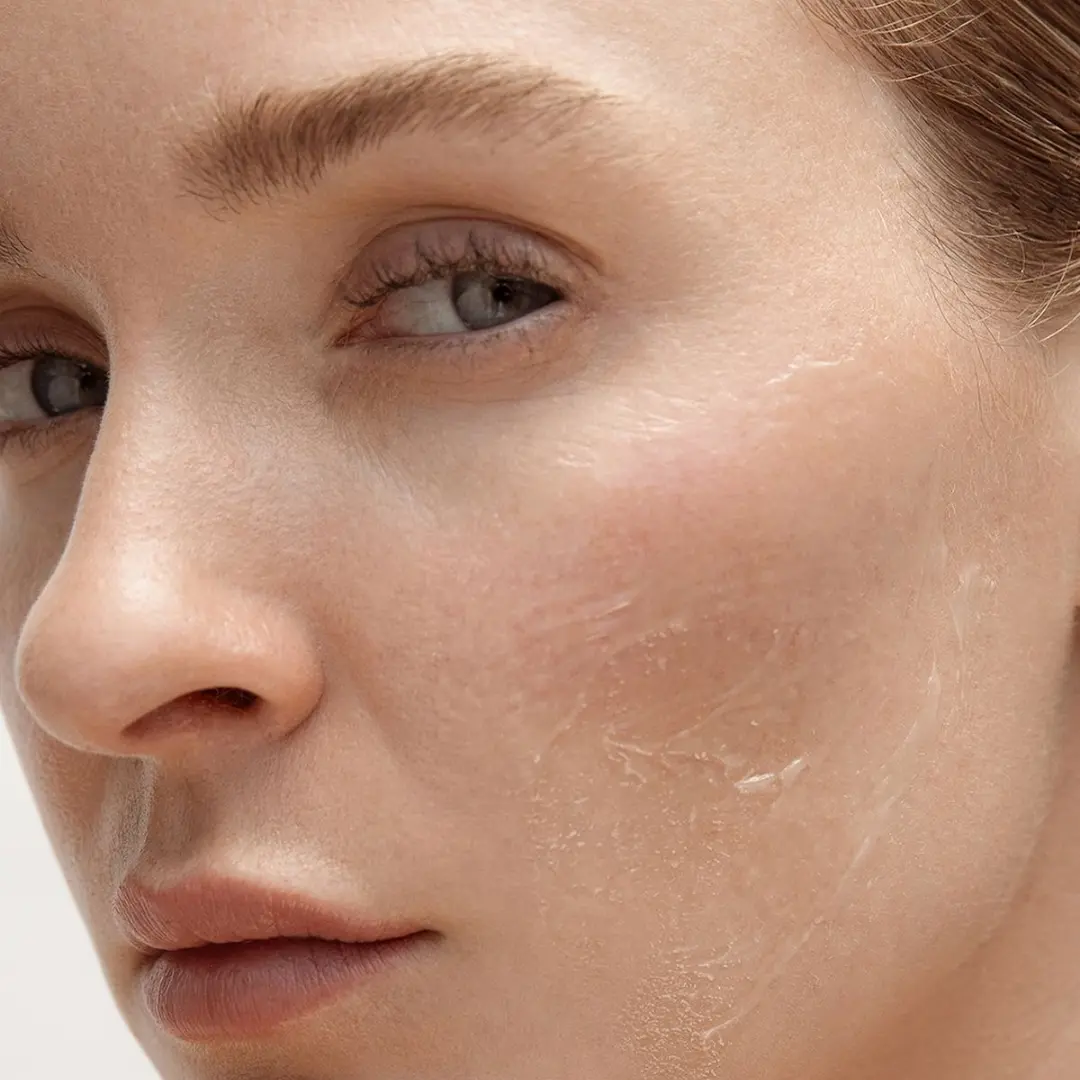 Dry Skin
